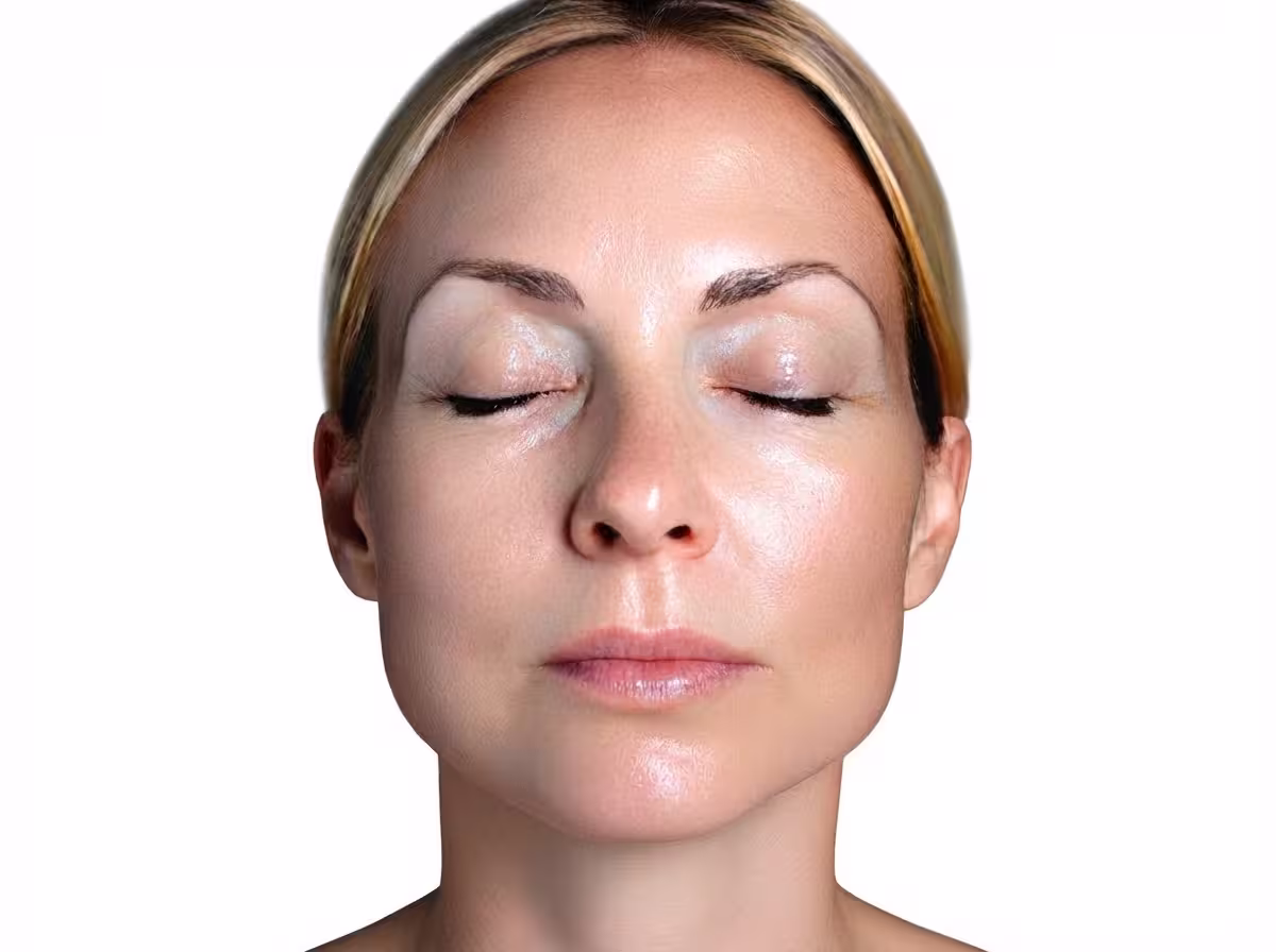 After treatment: clearer, more even skin